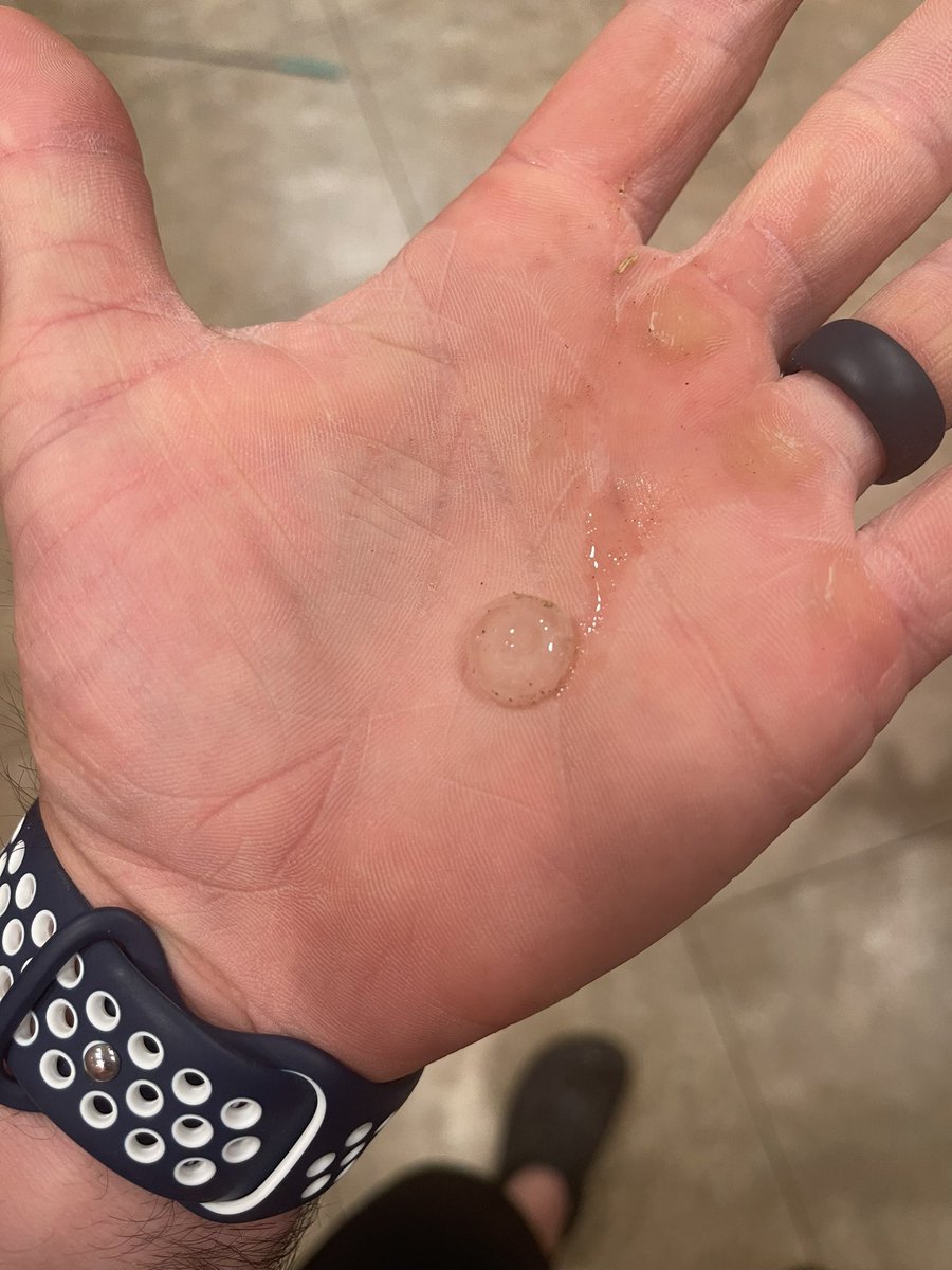 42mike_ford's tweet photo. @spann Hail coming down in Loxley, Al. 
#alwx https://t.co/JZmrFzAFNs