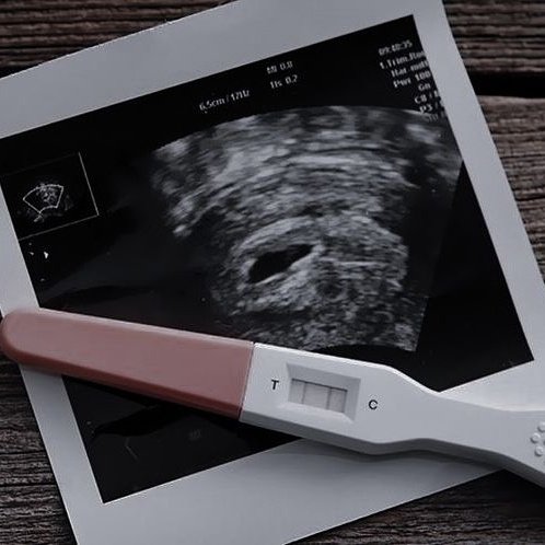 ㅤ ㅤ ㅤ 
ㅤ ㅤ ㅤ 
ㅤ ㅤ ㅤ   🧸   ˖   𝂅  𝑏𝑎𝑏𝑦   𝑡𝑤𝑜 𝑤𝑒𝑒𝑘𝑠  יִ
ㅤ ㅤ  enjoαdα..  esfomeαdα..  estressαdα   .. grαvidα

  ㅤ ㅤ