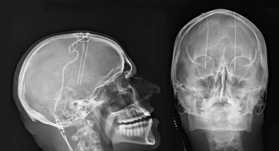 BSmuda's tweet photo. Bring 'em out 
Bring 'em out 
Bring 'em out

Soon I'll be live from the OR
Slice me open 6 but no more
Replace the old implant with double what I got
80 staples to the head babe you know it's hot
Pack up my pecks with twice the juice
Gonna be 24V yo time to get loose! https://t.co/aAjLrusxV0