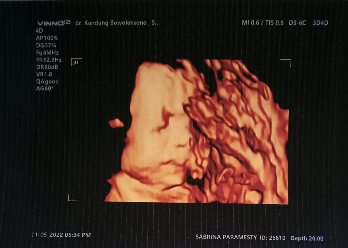 Can't wait to meet you❤️