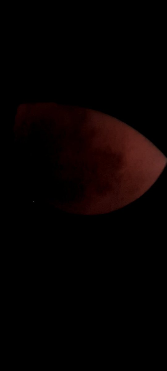 #EclipseLunar  es hermosa
