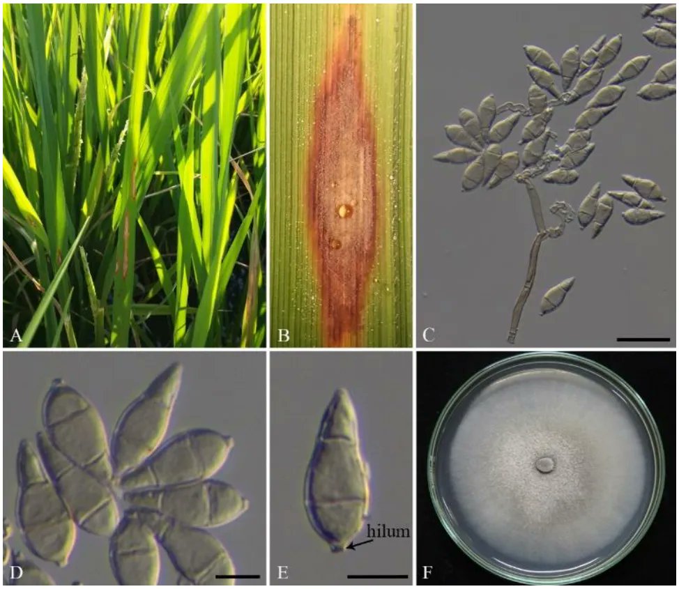 Le projet Diapason c'est un diagnostique de la pyriculariose qui touche les graminées causé par pyricularia oryzae. Nous y travaillons avec le <a href="/Cirad/">Cirad</a> #PlanFranceRelance

source img: buff.ly/3FpMPln