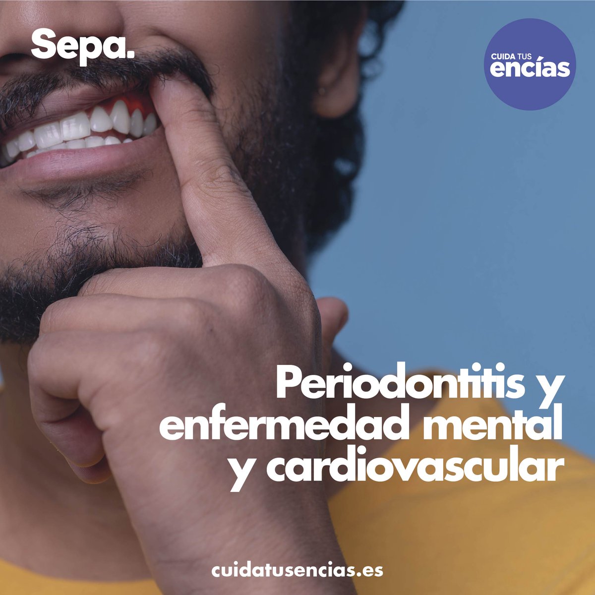 Una nueva investigación publicada en <a href="/BMJOpenQuality/">BMJ Open Quality</a>  a más de 64.000 pacientes  confirma que las personas con una historia clínica de enfermedad periodontal tienen un mayor riesgo de sufrir enfermedades cardiovasculares #saludoral #saludbucal #encías #dientes #dental