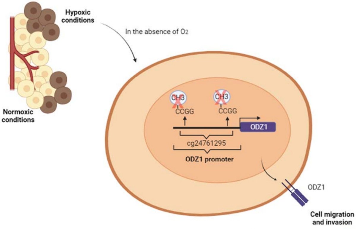 carvelhn's tweet photo. TENM1 (#ODZ1) is an #invasion factor in #Glioblastoma. Here we review the #signaling pathways regulating its expression @Biomed_MDPI.
https://t.co/oi9TJmEZxT
@IDIVALdecilla @HUnivValdecilla @NeuroRaquisHUMV @SociedadSENEC https://t.co/AFIarP5caT