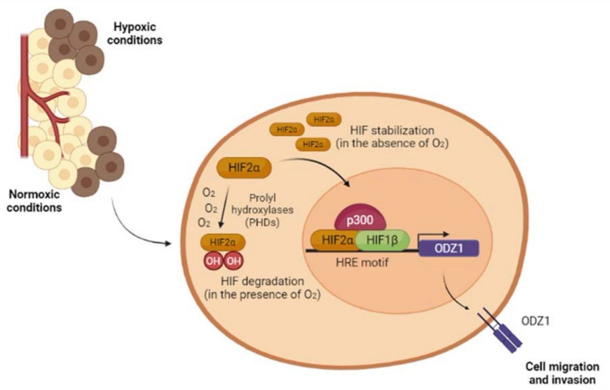 carvelhn's tweet photo. TENM1 (#ODZ1) is an #invasion factor in #Glioblastoma. Here we review the #signaling pathways regulating its expression @Biomed_MDPI.
https://t.co/oi9TJmEZxT
@IDIVALdecilla @HUnivValdecilla @NeuroRaquisHUMV @SociedadSENEC https://t.co/AFIarP5caT