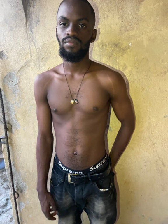 Remmzor__'s tweet photo. Valentine Nwachukwu, a 400 level Psychology student in UNILAG, was recently diagnosed with stage 4 Skin Cancer. He now needs our help to raise the money for this treatment.
He is to undergo chemotherapy for minimum of one year, a treatment which is estimated to cost around N12M https://t.co/sWW51uAFVF