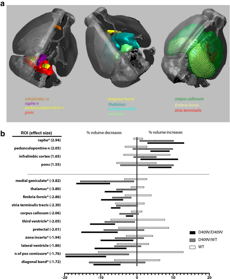 New paper from <a href="/KingsIoPPN/">Institute of Psychiatry, Psychology & Neuroscience</a> <a href="/ExeterMed/">Exeter Med School</a> <a href="/brain_kcl/">BRAIN</a> researchers reports the EEG phenotype of #Parkinsons-related GBA-mutation (D409V/WT) mice; Specific structural changes in the more widespread sleep neurocircuitry; Findings are in keeping with human data
nature.com/articles/s4159…