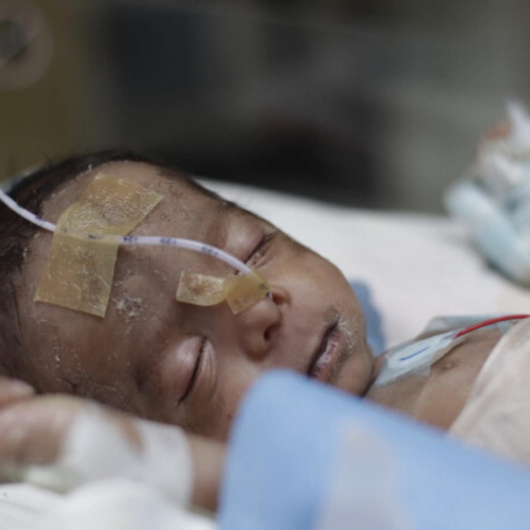 “We lost a baby, and we sold off our farm and we took out all the money we could borrow. He needs one more surgery. We have nothing except this child now. God has to help us save him. What do we have left now?” – Yogendra, father.

 Support: bit.ly/help-sashiprab…