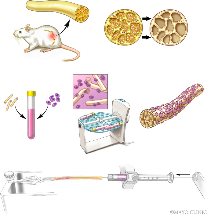 Nicholas Pulos, MD (@nickpulosmd) on Twitter photo Check out our study comparing dynamic seeding to microinjection of stem cells for enhancement of nerve allografts in <a href="/JPRASurg/">@JPRAS</a> now! <a href="/MayoOrthoRes/">Mayo Orthopedic Residency</a> <a href="/mayoclinichand/">@MayoClinicHand</a>
authors.elsevier.com/c/1f3ls6DcgayR… Check out our study comparing dynamic seeding to microinjection of stem cells for enhancement of nerve allografts in <a href="/JPRASurg/">@JPRAS</a> now! <a href="/MayoOrthoRes/">Mayo Orthopedic Residency</a> <a href="/mayoclinichand/">@MayoClinicHand</a>
authors.elsevier.com/c/1f3ls6DcgayR…