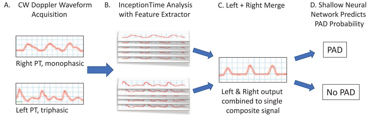 VMJ_SVM's tweet photo. Can we develop novel screening tools to assess for the presence of peripheral artery disease?

Here, McBane et al. use artificial intelligence for the identification of #PAD using arterial Doppler waveforms to predict abnormal ankle-brachial index.
https://t.co/l4K7iBOwbY https://t.co/pSWpLOa0wO