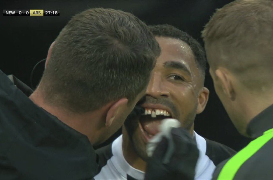 talkSPORT's tweet photo. 😬 #NEWARS https://t.co/6E62PlwLM8