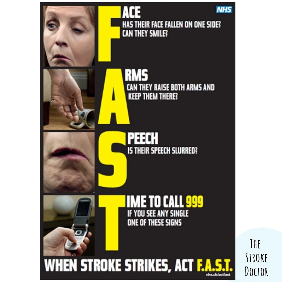 NicolaVella4's tweet photo. Well and truly got stuck back into the Stroke team at Oxford University Hospitals today. 7 stroke calls by lunchtime!  And referred some patients who have had stroke symptoms for a few days and didn't seek help. Don't ignore limb weakness! #fastpositive #ouh #stroketeam https://t.co/HwoJCuBWOl