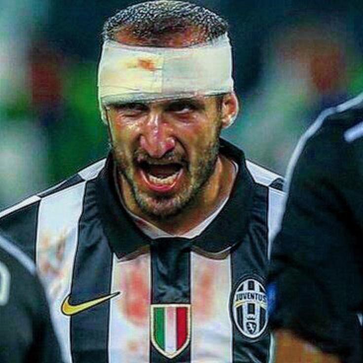 FMFranceschelli's tweet photo. #Giorgione @chiellini semplicemente grazie https://t.co/k6bxuNGmtC