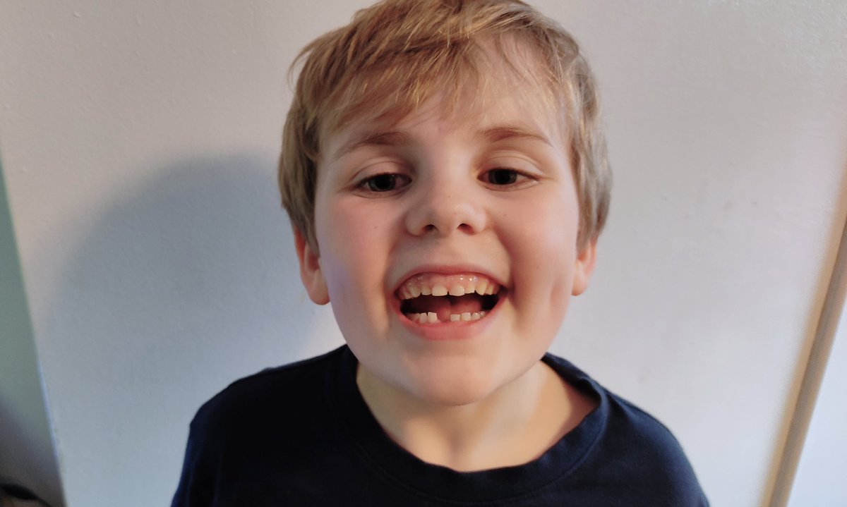 ChiswellSarah's tweet photo. I hope the #ToothFairy is on duty tonight! #FirstToothOut 🧚🪙😁 https://t.co/5jsITRLE6f