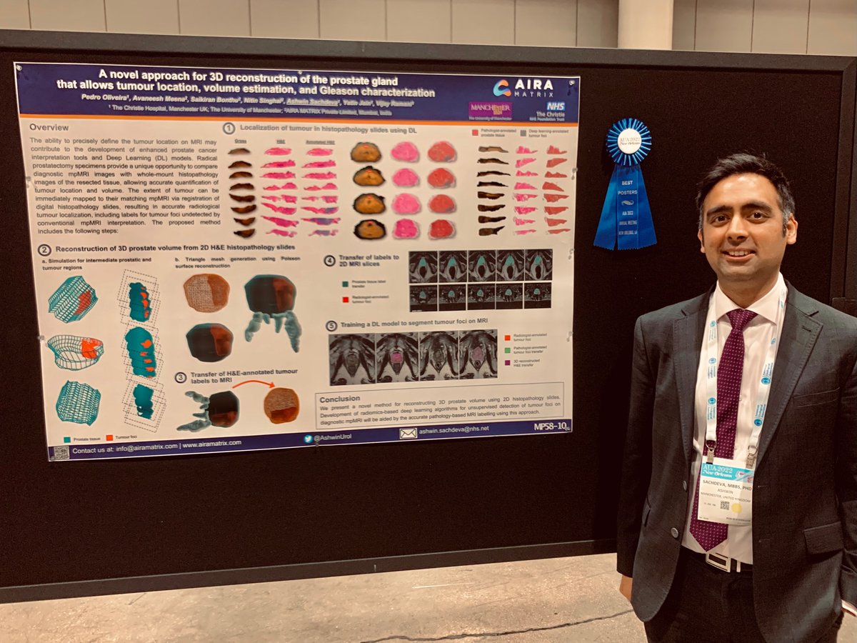 Delighted to win the Best Poster Prize 🏆 at #AUA22 for our collaborative project applying artificial intelligence 🤖 in prostate cancer imaging with <a href="/airamatrix/">AIRA MATRIX</a> <a href="/PedroOlivps/">Pedro Oliveira</a>