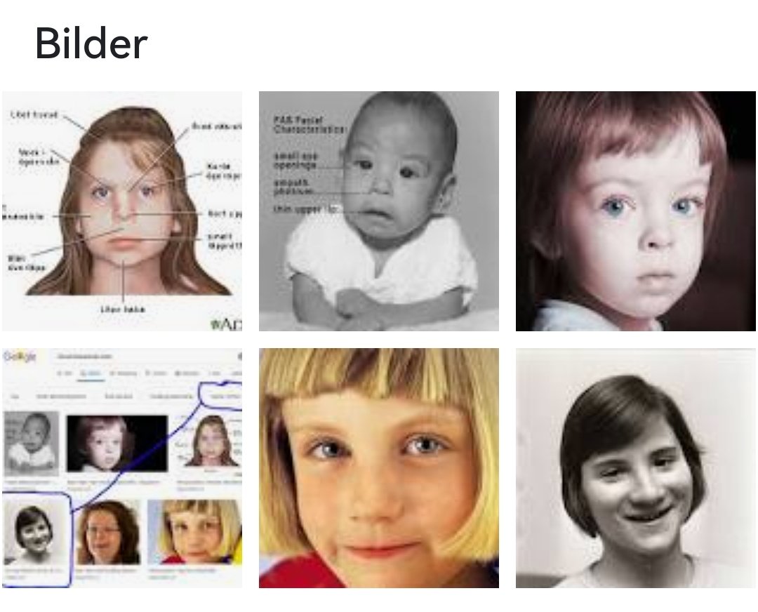 Hej Google!
Visa bilder på alkoholskadade barn!