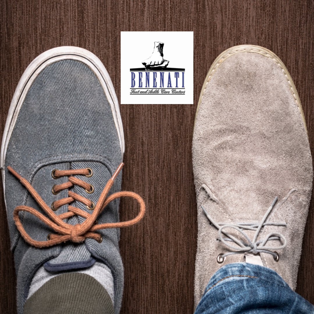 BenenatiFoot's tweet photo. Are your feet two different sizes? Well, know that you are not alone! Having different-sized feet is more common than having feet the same size. Find out more about your feet at https://t.co/R13cW1wdLc

#BenenatiFootandAnkleCareCenters #SplitSizes #DifferentSizedFeet #Podiatrist https://t.co/dIxrAHl509
