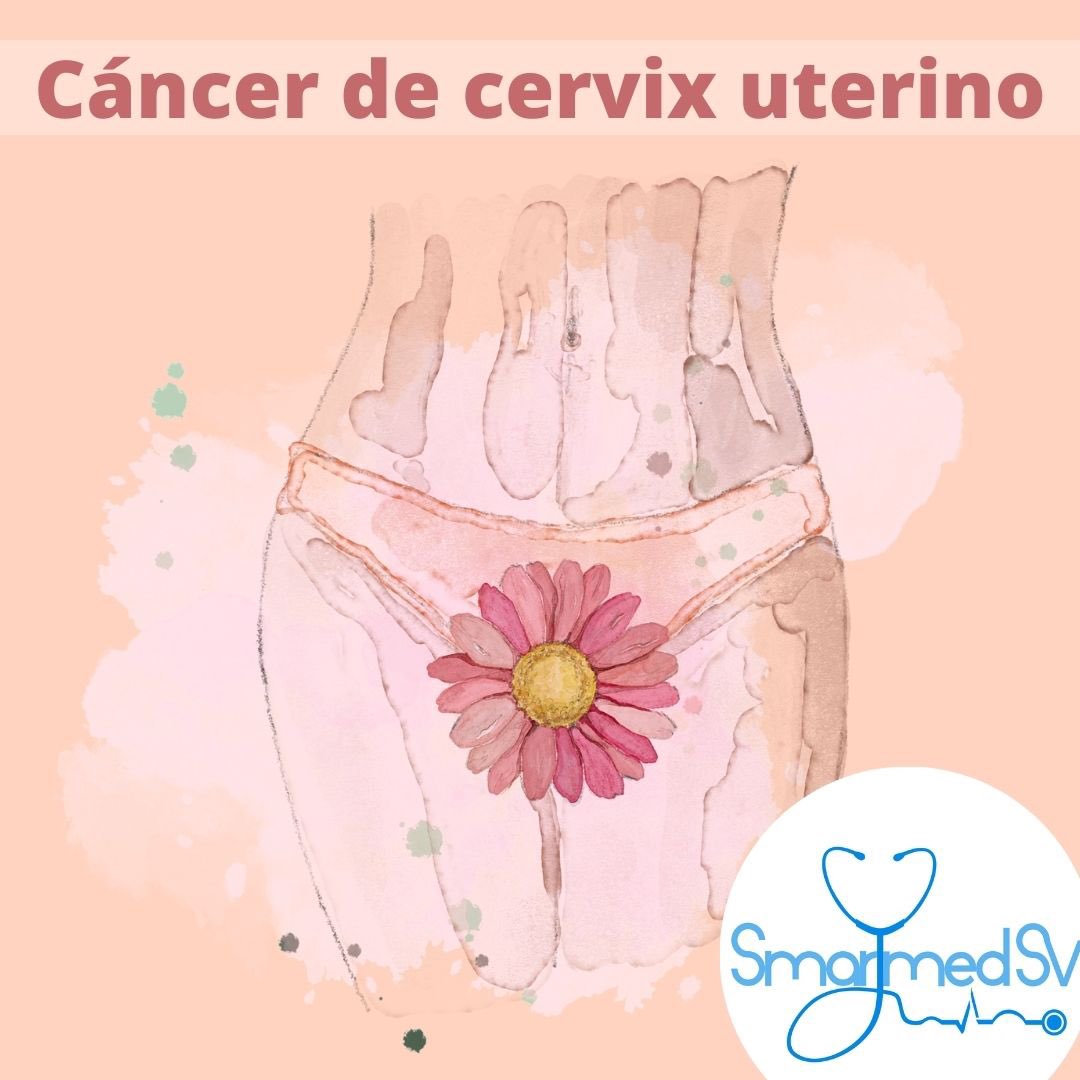 SmartMed_sv's tweet photo. 🚨Cáncer de cervix uterino🚨 #smarttalksv #Smartmed_sv #Prevencion 👩⚕️🩺. Escrito por : @KathyaJimenezMD https://t.co/lB7yH53VHg
