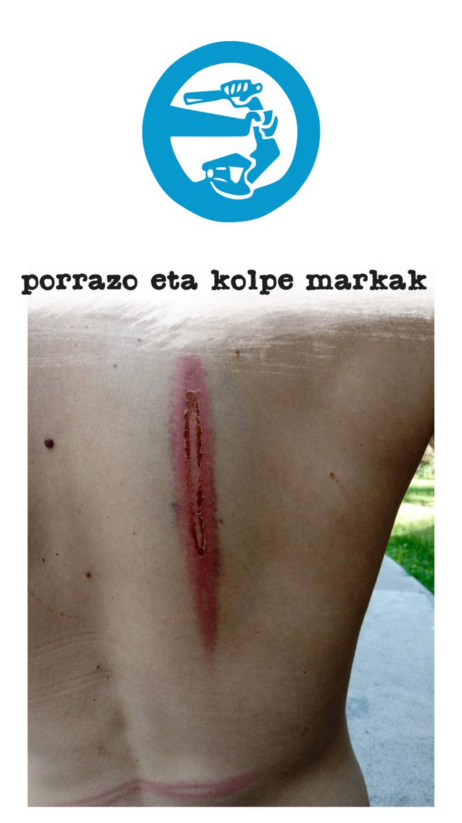 Bultzada TxuriUrdina (@bultzadatx) on Twitter photo 