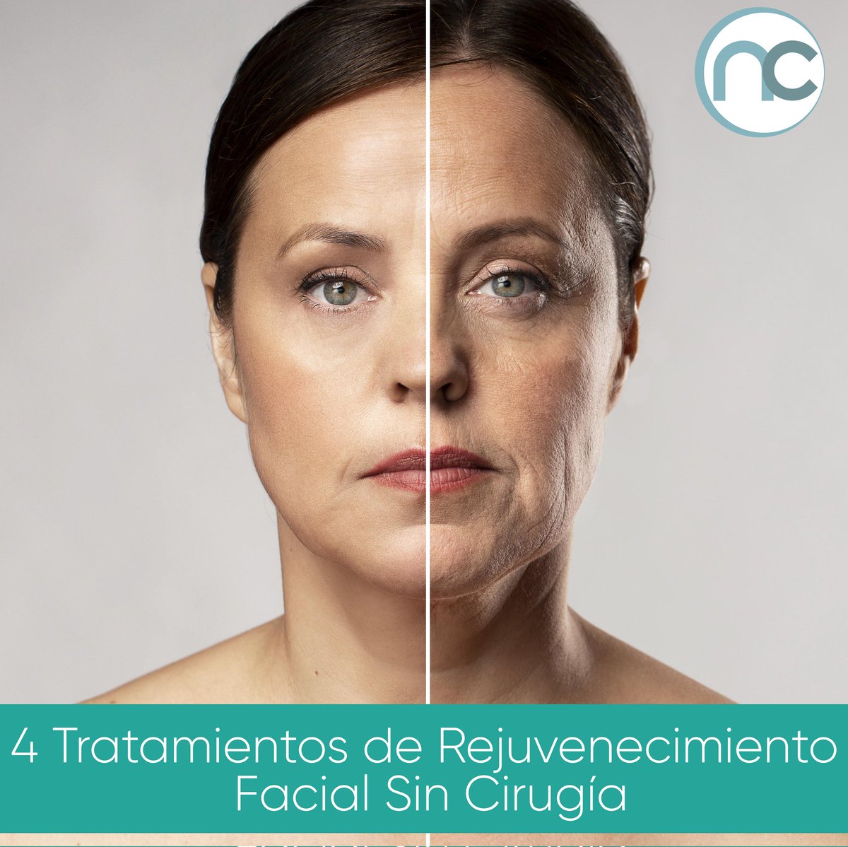 drnelsonchaves's tweet photo. 𝟒 𝐭𝐫𝐚𝐭𝐚𝐦𝐢𝐞𝐧𝐭𝐨𝐬 𝐝𝐞 𝐑𝐞𝐣𝐮𝐯𝐞𝐧𝐞𝐜𝐢𝐦𝐢𝐞𝐧𝐭𝐨 𝐅𝐚𝐜𝐢𝐚𝐥 𝐒𝐢𝐧 𝐂𝐢𝐫𝐮𝐠𝐢́𝐚 💆🏻‍♀️

✔️ 𝐓𝐨𝐱𝐢𝐧𝐚 𝐁𝐨𝐭𝐮𝐥𝐢́𝐧𝐢𝐜𝐚
✔️ 𝐀́𝐜𝐢𝐝𝐨 𝐇𝐢𝐚𝐥𝐮𝐫𝐨́𝐧𝐢𝐜𝐨
✔️ 𝐋𝐢𝐩𝐨𝐢𝐧𝐲𝐞𝐜𝐜𝐢𝐨́𝐧 𝐅𝐚𝐜𝐢𝐚𝐥
✔️ 𝐈𝐏𝐋 (𝐋𝐮𝐳 𝐏𝐮𝐥𝐬𝐚𝐝𝐚 𝐈𝐧𝐭𝐞𝐧𝐬𝐚) https://t.co/PAbWE9Pv6f