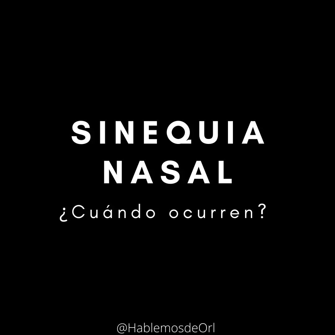 HablemosdeOrl's tweet photo. SINEQUIA NASAL 👃🏽

https://t.co/6uibReGwkX https://t.co/MHLX9KNxfs