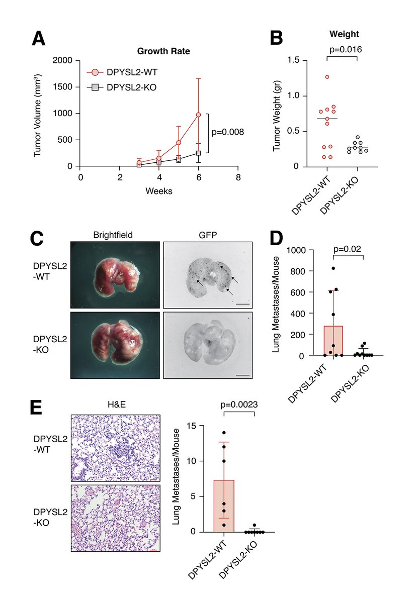 JCellBiol's tweet image. .@AreejRmaileh @yoavsha et al. @IMRIC_HUJ @Hujimed demonstrate that the axon guidance adaptor protein #DPYSL2 interacts w/ #JAK1 in aggressive #breastcancer cell lines to mediate their #migration via #STAT3 signaling and #vimentin. bit.ly/3wfEVIk

#CellSignaling #Cancer