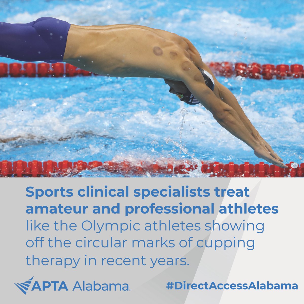 APTAAlabama's tweet photo. Board Certified Sports Physical therapists receive extra training focused on how to diagnose and treat common athletic injuries (in direct access states).
Letters behind their name?
SCS- Sports Certified Specialist
#PTSpecialtySpotlight
#DirectAccessAlabama https://t.co/Xgrc09Eygi