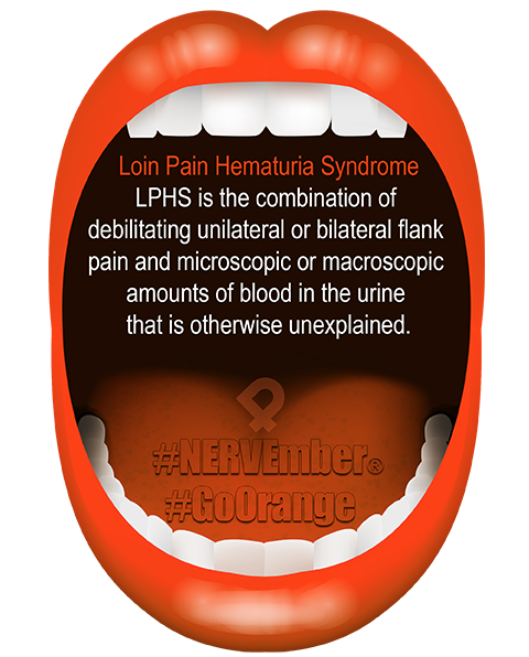 Loin pain hematuria syndrome (LPHS) is the combination of debilitating unilateral or bilateral flank pain & microscopic or macroscopic amounts of blood in the urine that is unexplained.

Read more here ow.ly/qN8J50J79NM

#flankpain #loinpain #chronicpain #renalpain