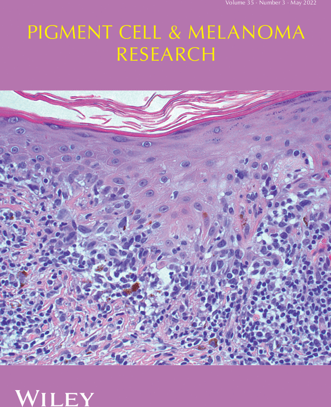Pigment Cell & Melanoma Research tweet media
