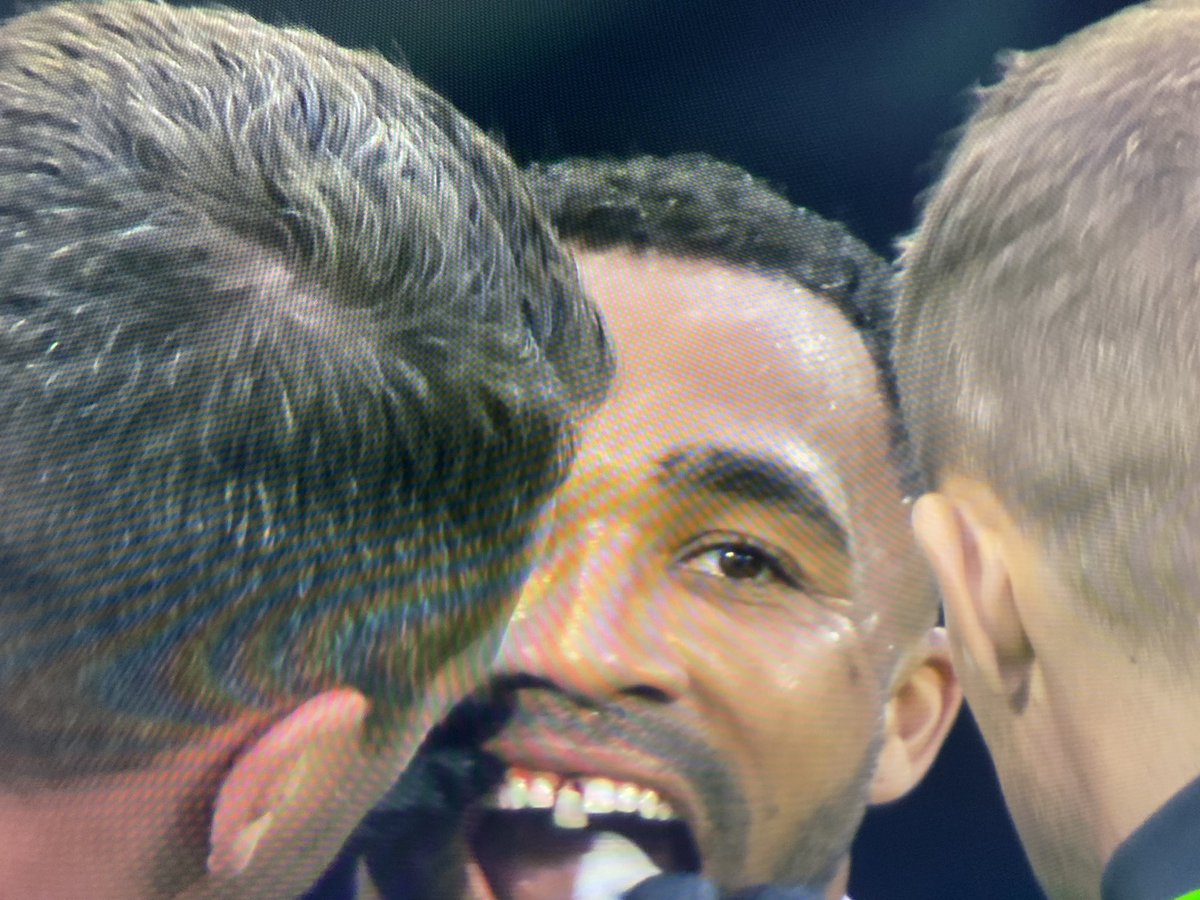 toonarmy_com's tweet photo. Callum Wilson’s tooth 🤕 https://t.co/CJHH5sfVQp