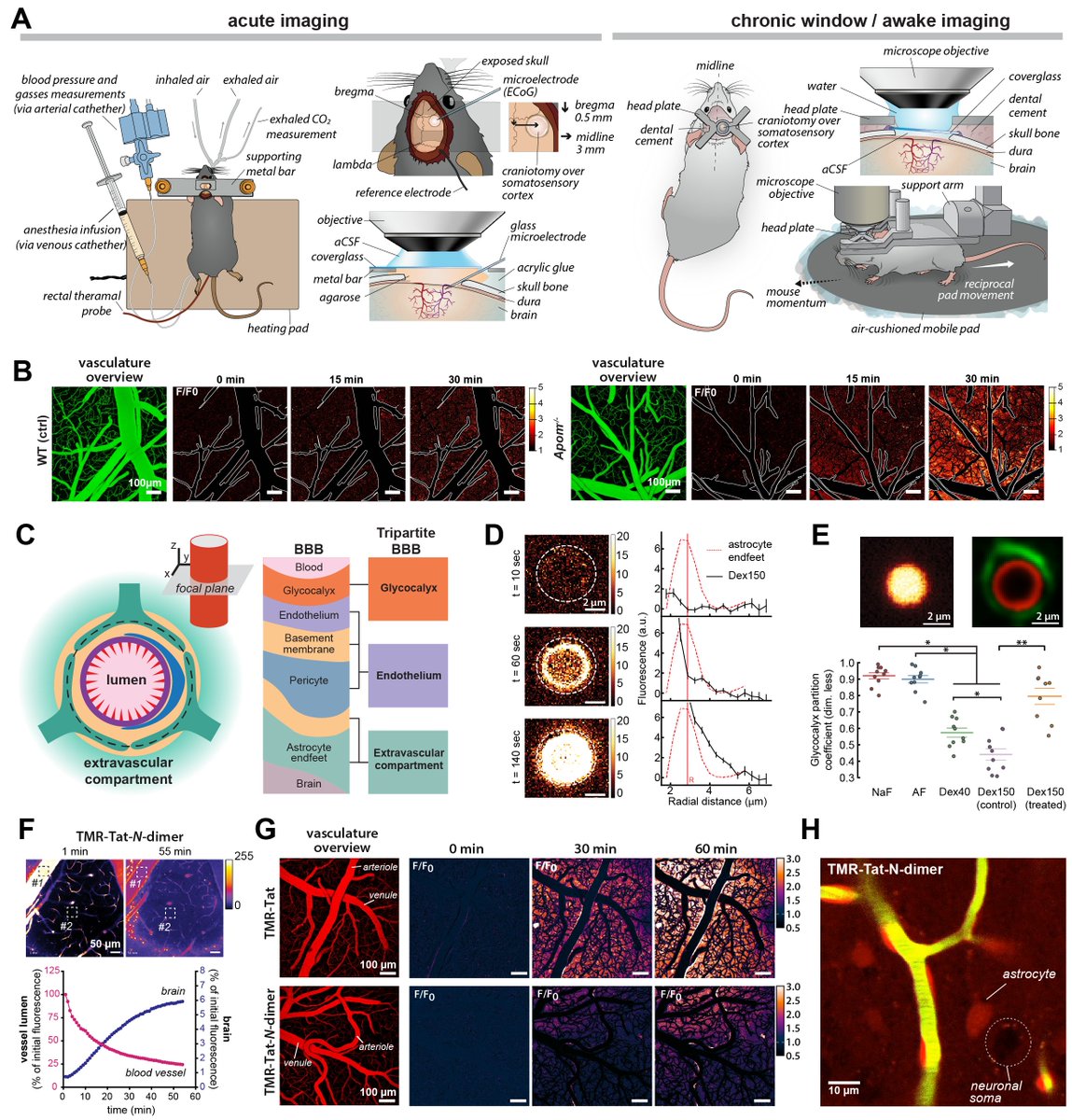 How to use #twophoton #microscopy to investigate #bloodbrainbarrier transport and #CNS #drugdelivery? Check the summary of our work @transneuro_lab, where we pit  #fluorescence #imaging #invivo against classical approaches to study the #brain and #BBB tinyurl.com/2p9bwbj9