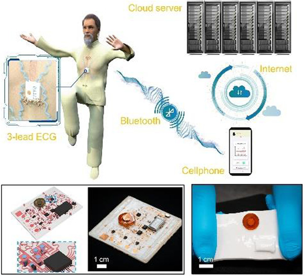 SmartMat2's tweet image. Check out the latest Article about Soft, stretchable, wireless #intelligent three‐lead #electrocardiograph monitors with feedback functions for warning of potential #HeartAttack. By Xinge Yu @CityUHongKong @Wiley_Chemistry 
Read it: doi.org/10.1002/smm2.1…