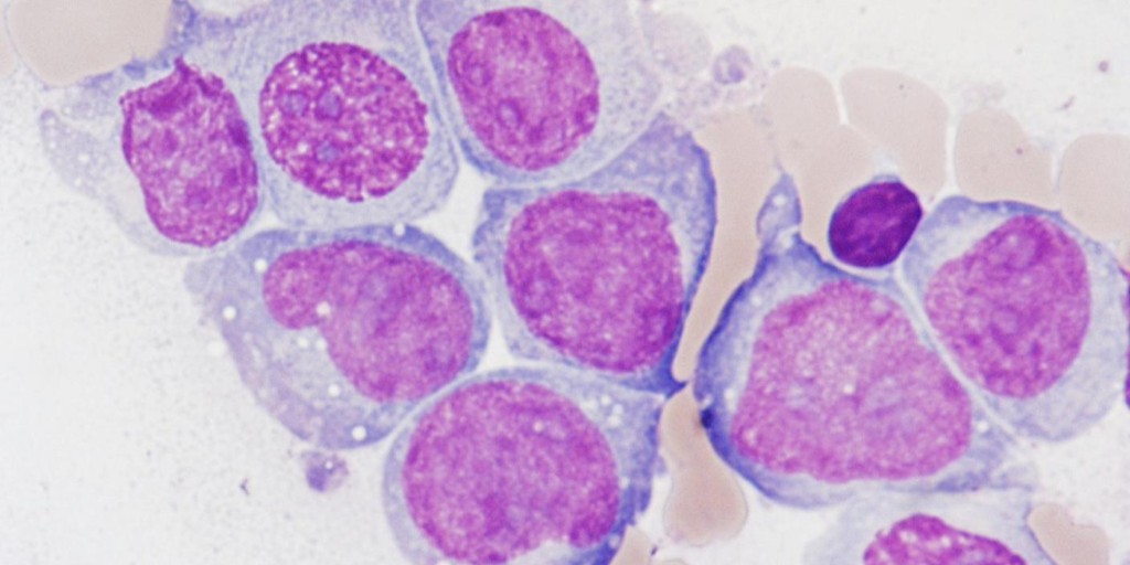 Watch Dr. Jacquelyn Zoine’s talk, “Peptide-scFv Bispecific CAR T-cells Targeting Acute Myeloid Leukemia,” today at 5 pm ET in the CAR T-cells and Beyond session in Room 102 at #ASGCT22. ow.ly/4J3J50J8nkM @JTZoine