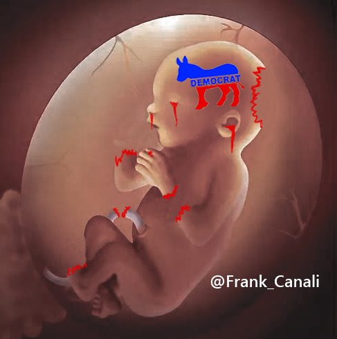 frank_canali's tweet photo. @Klueklo @papi_wolf5 It's unfortunate we can't only abort "Unviable Tissue Masses" from Democrat mothers..... fewer democrat bastards/future voters would be a Great thing for the country. https://t.co/5LbxPhTCKG