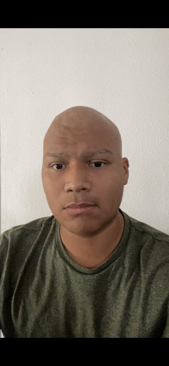 morrochonito's tweet photo. seeing these two pictures really brings tears to my eyes. During chemo I just looked forward to the days where I had hair again. 3 months post chemo and I feel like it’s coming back better than ever #fuckcancer https://t.co/JBaZkQq0oi