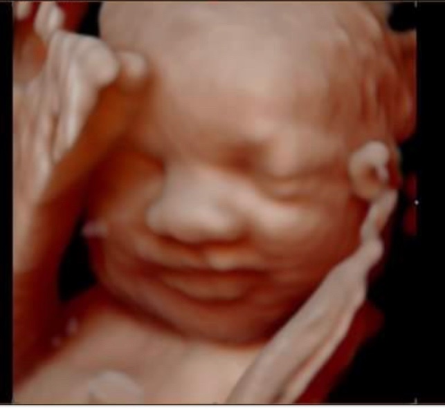 SoulObserver's tweet image. Looking at these sweet ultrasound pictures of my new baby niece makes me sad to think half of my fellow Americans would be perfectly ok to deny her the right to live ☹️