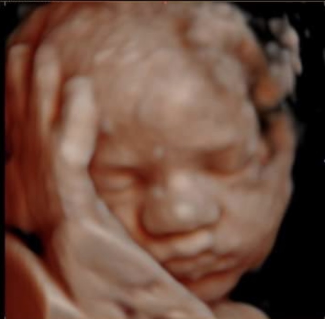 SoulObserver's tweet image. Looking at these sweet ultrasound pictures of my new baby niece makes me sad to think half of my fellow Americans would be perfectly ok to deny her the right to live ☹️