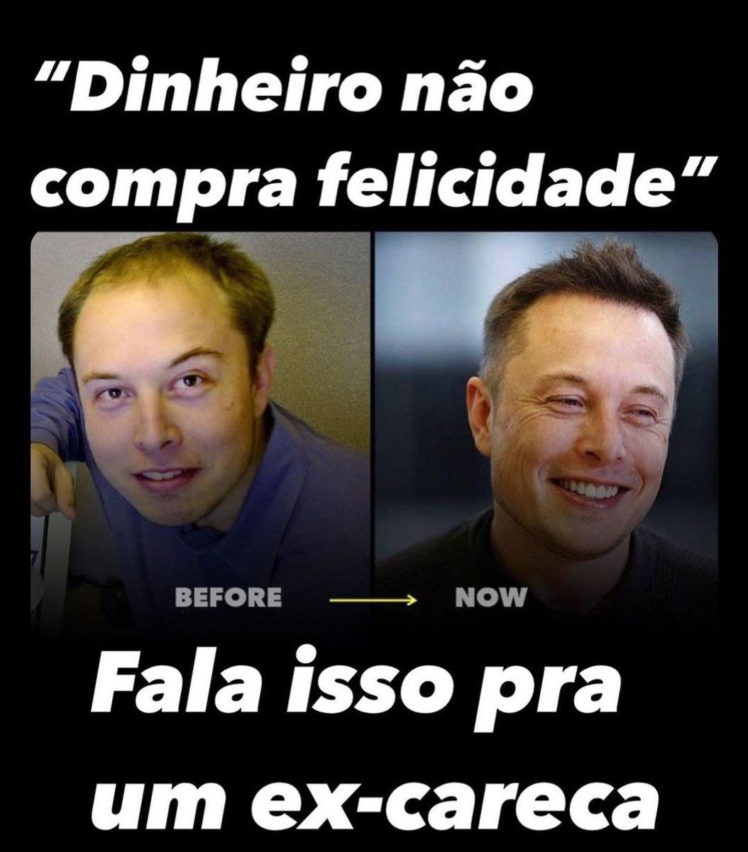 DosFalidos's tweet photo. Esse é meu objetivo de ser tão rico que até o cabelo volta a crescer novamente... 🤣 https://t.co/eR5w8TRmOC