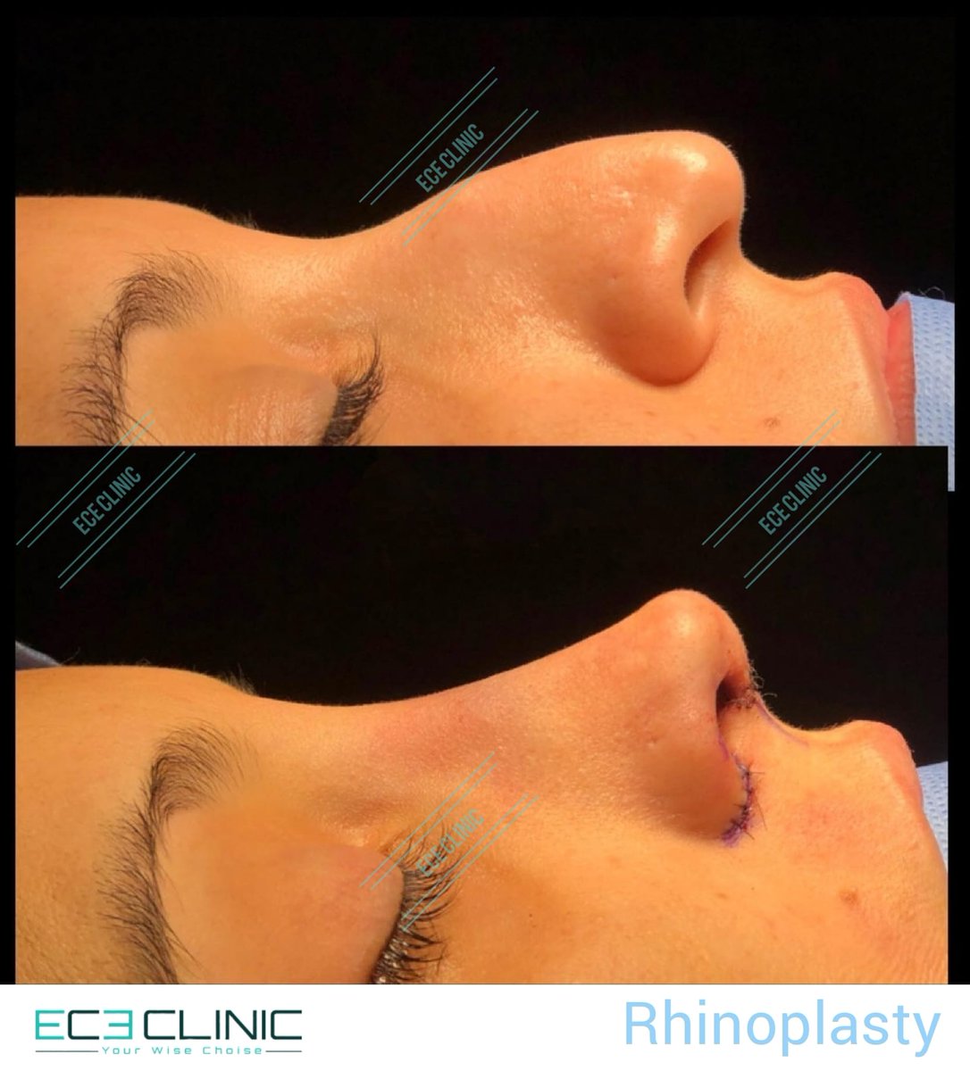 ECE Clinic (@EceClinic) / Posts / X