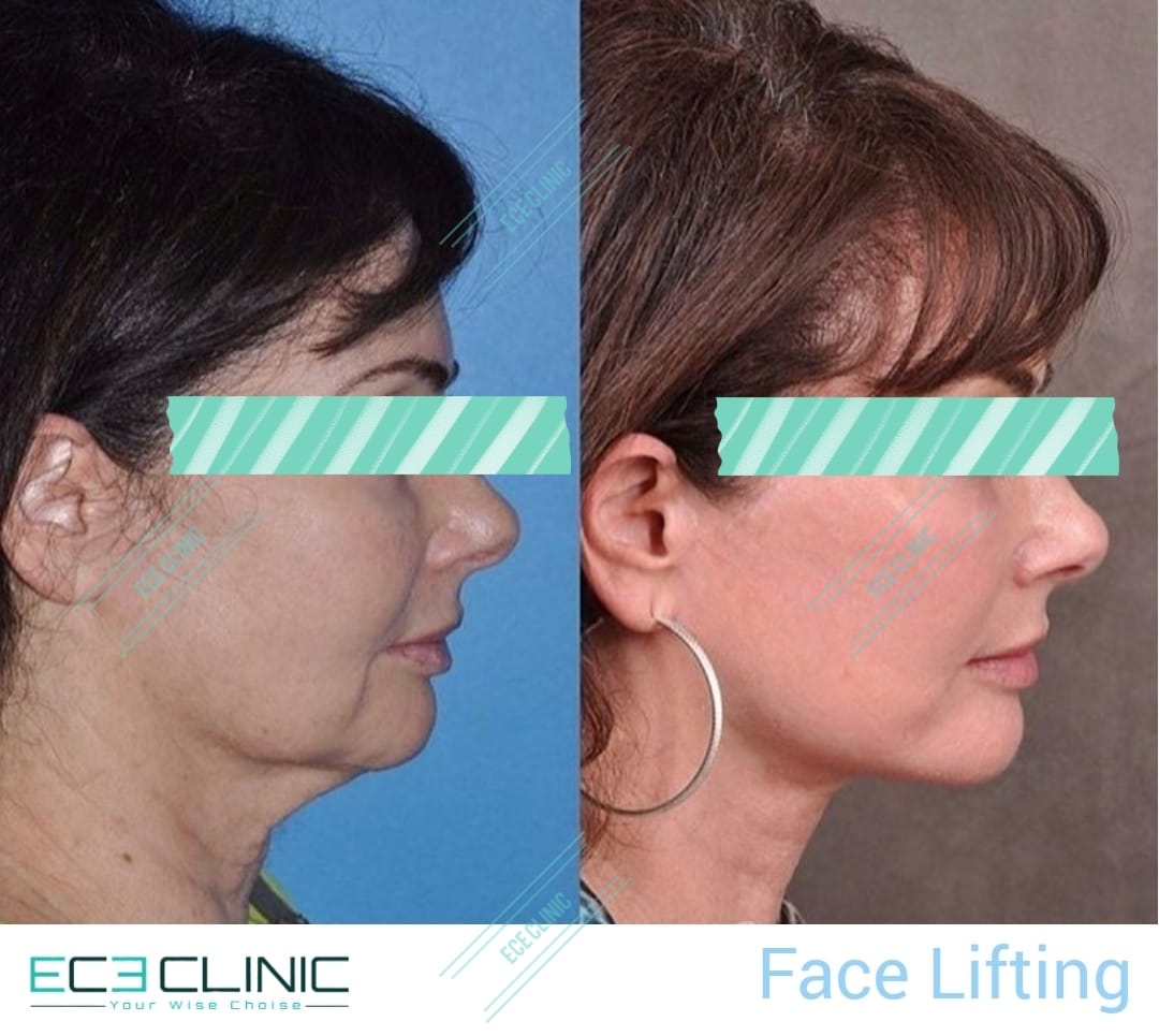 ECE Clinic (@EceClinic) / Posts / X
