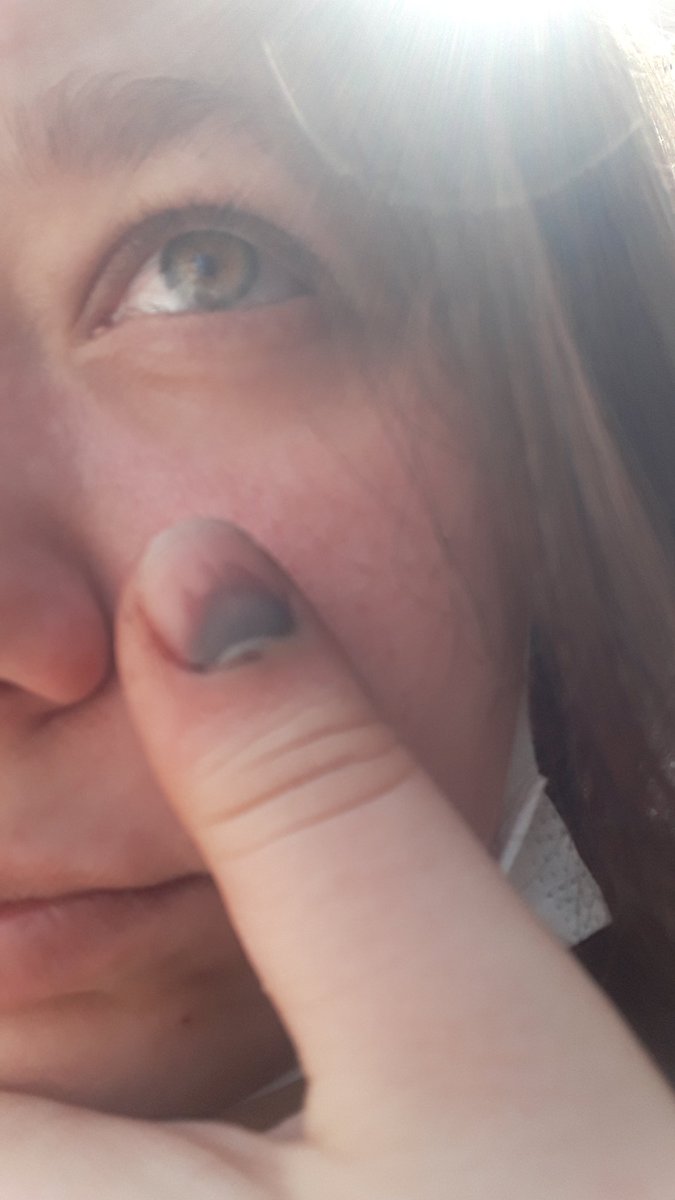 haticekrr_'s tweet photo. @Kaankrr_ Sus parmağam koptu 😭😭 https://t.co/sL7TMPeTVG