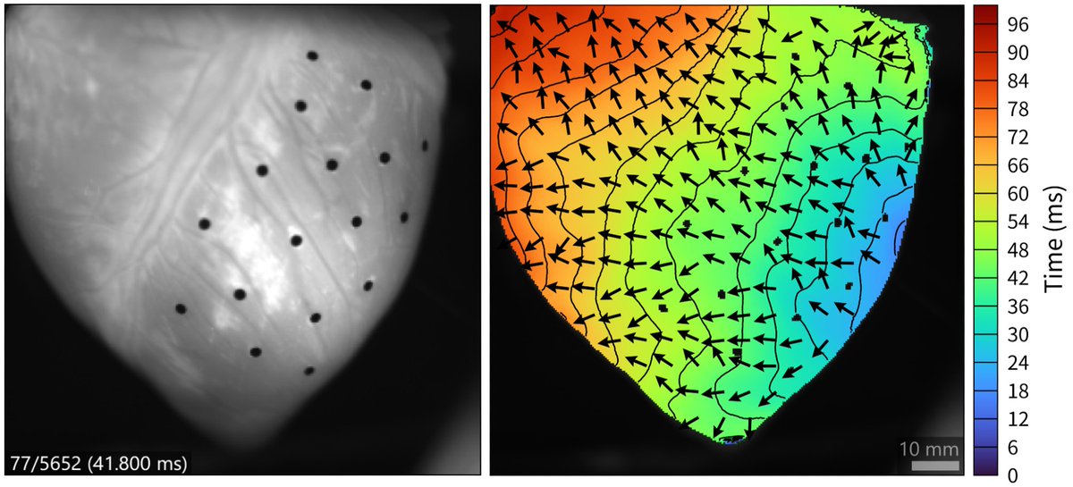 Optical mapping data analysis software BV Workbench can display conduction velocity vectors on activation maps.
scimedia.com/products/sw/bv…
#activationmap #conductionvelocity #opticalmapping