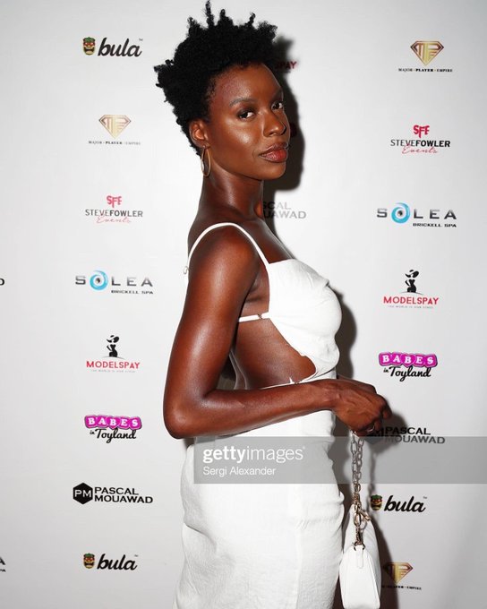 Just me again. https://t.co/A9x7rldPgH<a href="/tag/savagesummer"class="tags"><span>#savagesummer</span></a><a href="/tag/donteditmyscar"class="tags"><span>#donteditmyscar</span></a><a href="/tag/lipomaremoval"class="tags"><span>#lipomaremoval</span></a>