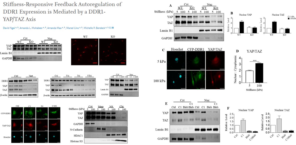HaoYin20's tweet photo. DDR1 as mechano-chemical sensor for #MatrixStiffness & Collagen to activate #YAP/TAZ in #SmoothMuscleCell
& YAP/TAZ transcribe DDR1
Fascinating DDR1-YAP/TAZ loop in vascular disorders to explore🤠
Dr Michelle Bendeck lab @BendeckBendeck Matrix Biol 2022
https://t.co/V9dE2nln4f https://t.co/zAMwMywnH8