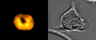 Found a black hole! But this one is in a neutrophil migrating in our microfluidic chips. Also, 10^15 times smaller than Sagittarius A*.  #BlackHole