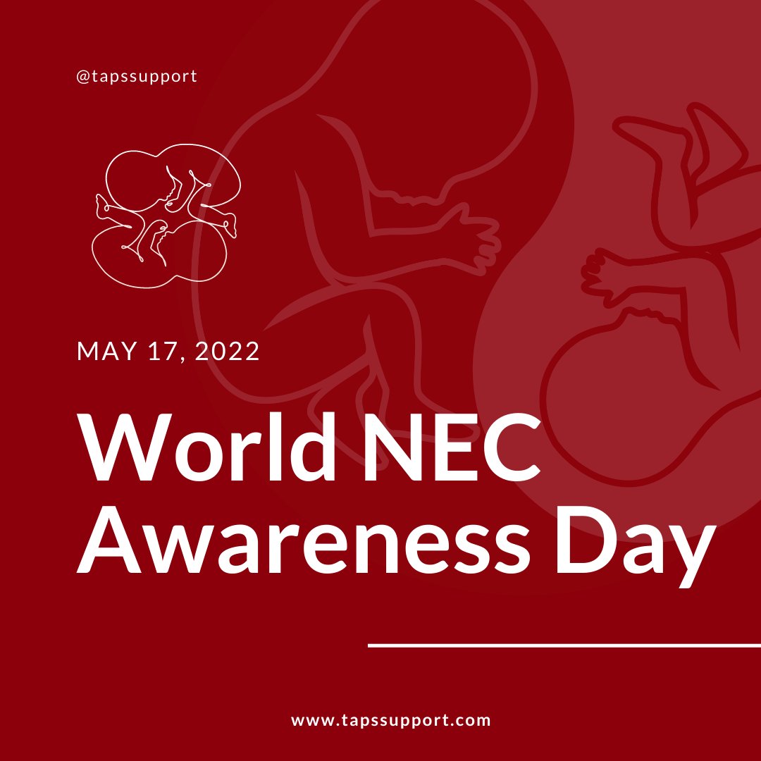 tapssupport's tweet photo. NEC is mostly seen in premature and at-risk babies. It progresses quickly, and can be fatal. TAPS twins can be affected.
More from @NECsociety : https://t.co/daHOw04Qal #tapssupport #tapsisreal #NECUK #becausetinybowelsmatter #togetherwecandosomuch #preventNEC #NECday #ThisIsNEC https://t.co/aWwEkQcYpQ