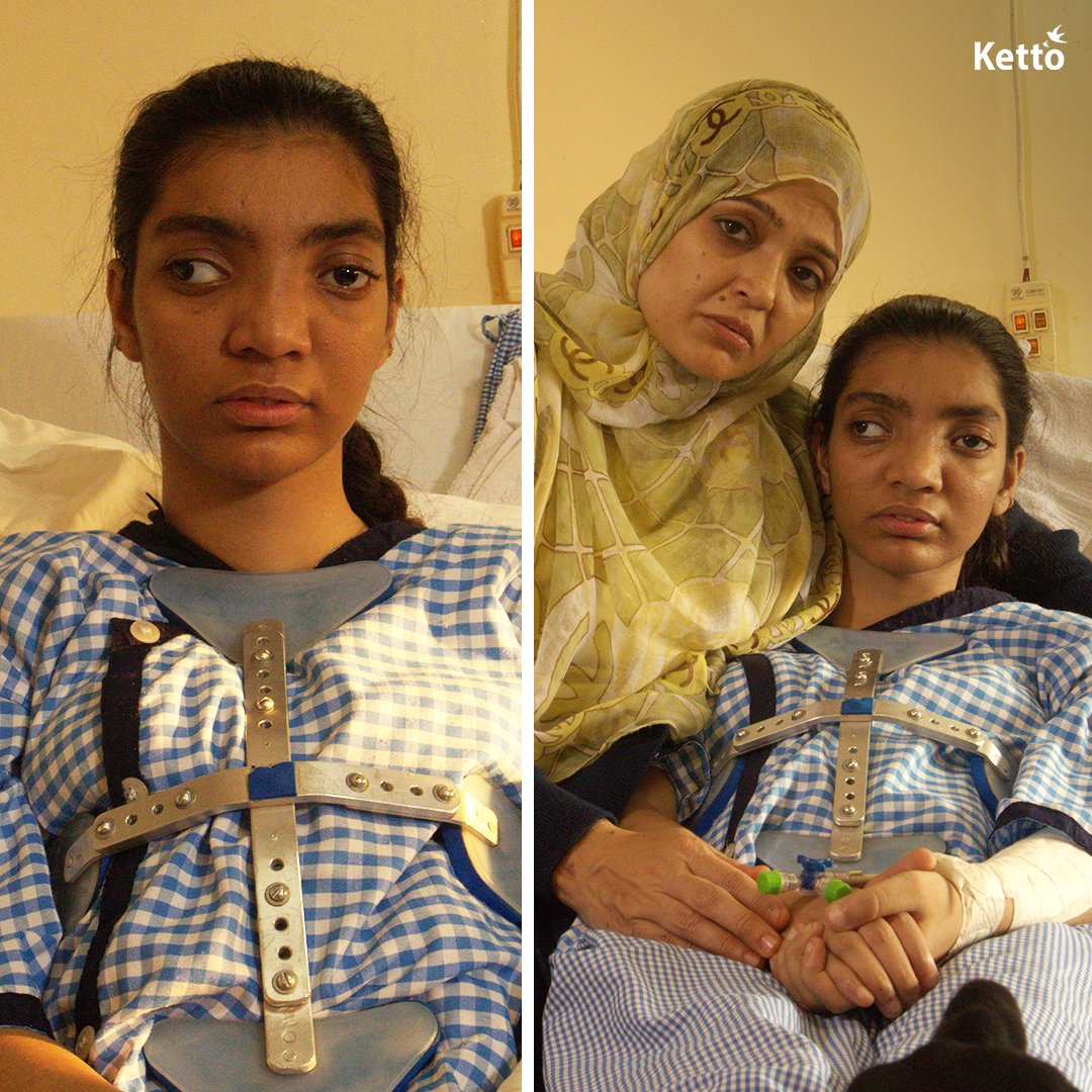 “My daughter is suffering from hyper IgE syndrome, due to which she lost her hearing when she was just 7 months old. She has a lung infection &amp; TB, but unfortunately, we can no longer afford her life-saving treatment. You are our only hope."

Please help: bit.ly/Save-Kareema
