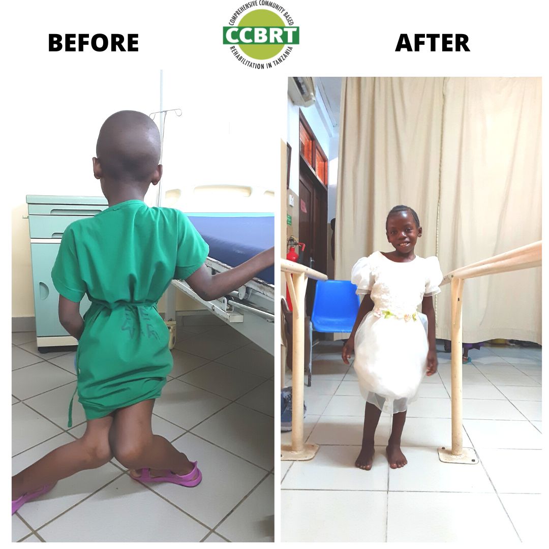 Without the appropriate treatment and care, physical impaired individuals struggle to complete day to day tasks, attend school, find a job and engage in their communities.