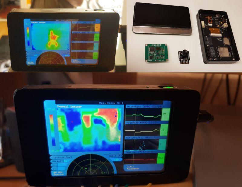👋<a href="/JayzonvanOeve/">Jayzon Oeve</a> publsihed a #medical tricorder project on <a href="/hackaday/">hackaday</a> . This device is based upon the #ESP32 TouchDown to gather vital signs of humans without contact. Up to a range of 2 meters movement of one's Lungs an Heart can be measured. Learn more: lnkd.in/gz-ucpEf