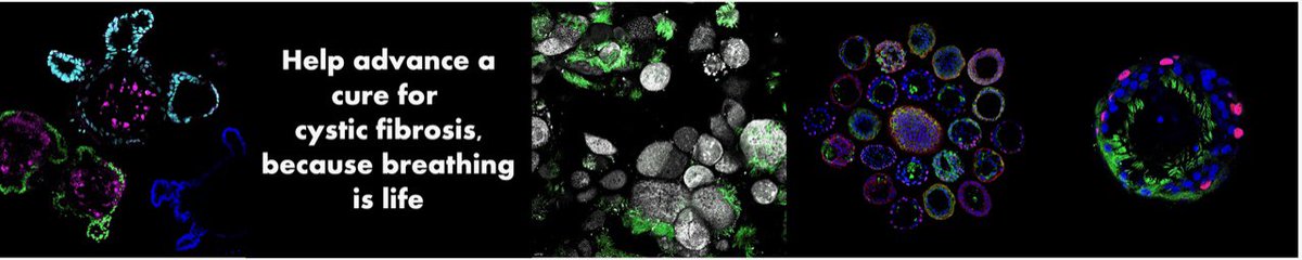 Dr Shafa Waters (@shafawaters) on Twitter photo May is #CFAwarenessMonth. Our #miCF beautiful microscopic images of lung and gut #Organoids are being displayed in the <a href="/SCHNkids/">Sydney Children's Hospitals Network</a> to raise awareness and funds for #cysticfibrosis . If you're interested in purchasing these artworks, please send an enquiry to art@schf.org.au May is #CFAwarenessMonth. Our #miCF beautiful microscopic images of lung and gut #Organoids are being displayed in the <a href="/SCHNkids/">Sydney Children's Hospitals Network</a> to raise awareness and funds for #cysticfibrosis . If you're interested in purchasing these artworks, please send an enquiry to art@schf.org.au